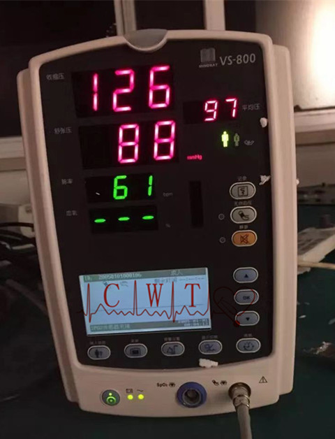 VS800 RESP NIBP SPO2 utilizó el monitor cardiaco de Mindray del monitor paciente